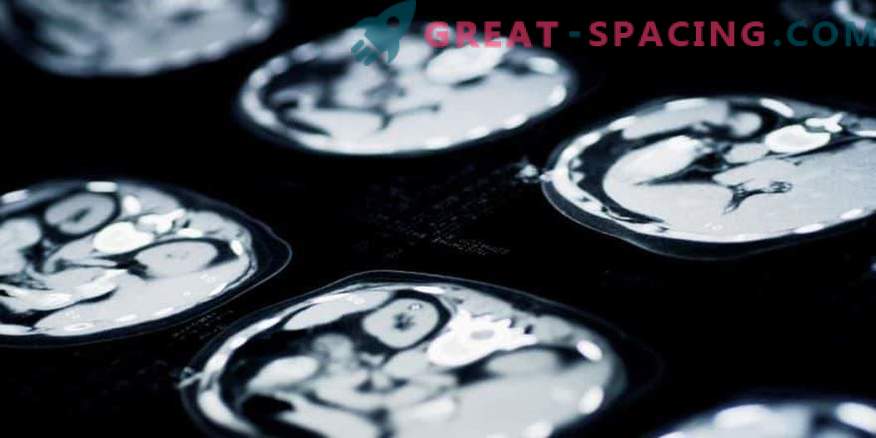 Spaceflight širi um, vendar stisne možgane